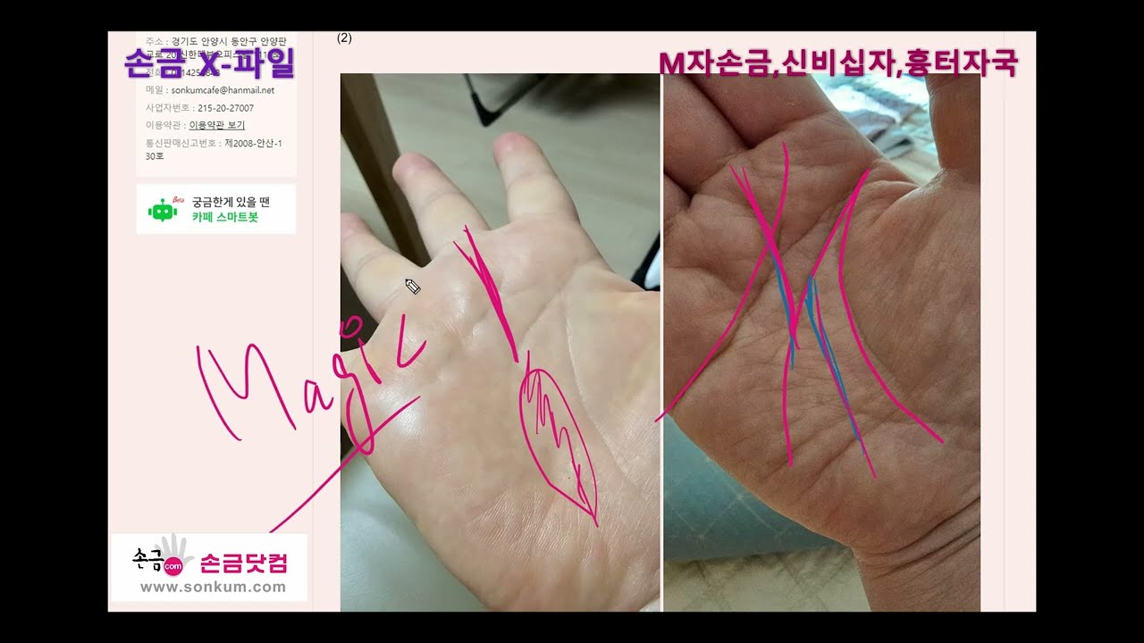 [손금X-파일] M자 손금, 신비십자, 부처의 눈, 흉터자국