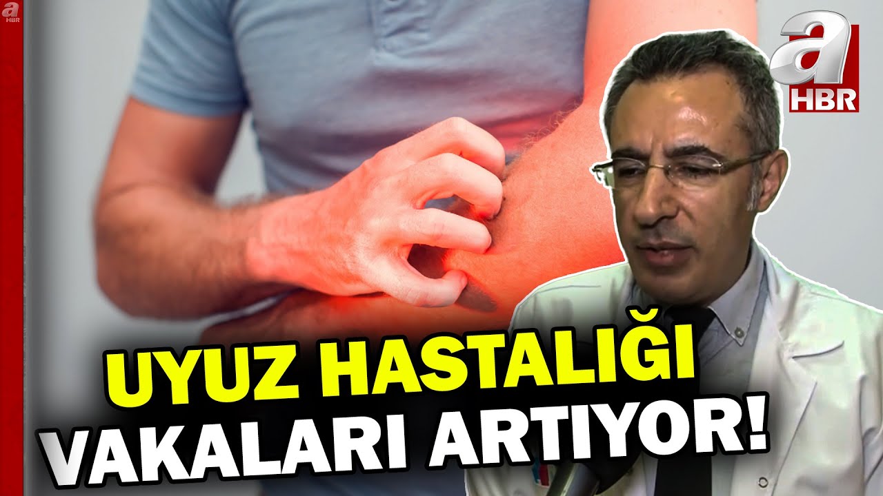 Uyuz vakaları artışa geçti! Uyuz hastalığına karşı nelere dikkat edilmeli?  | A Haber