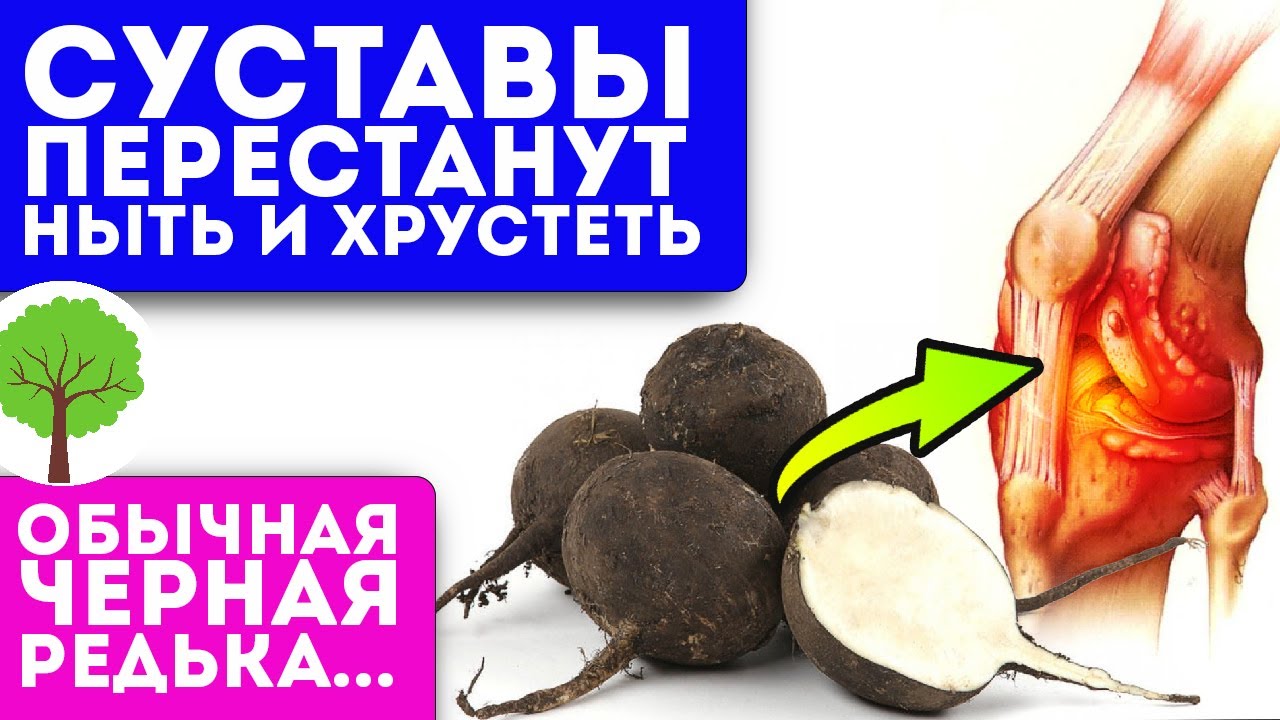 Без боли хожу по лестнице! Колени больше не болят после смеси редьки и...