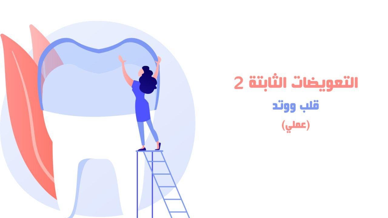 الوتد و القلب المعدني | Metal post and core