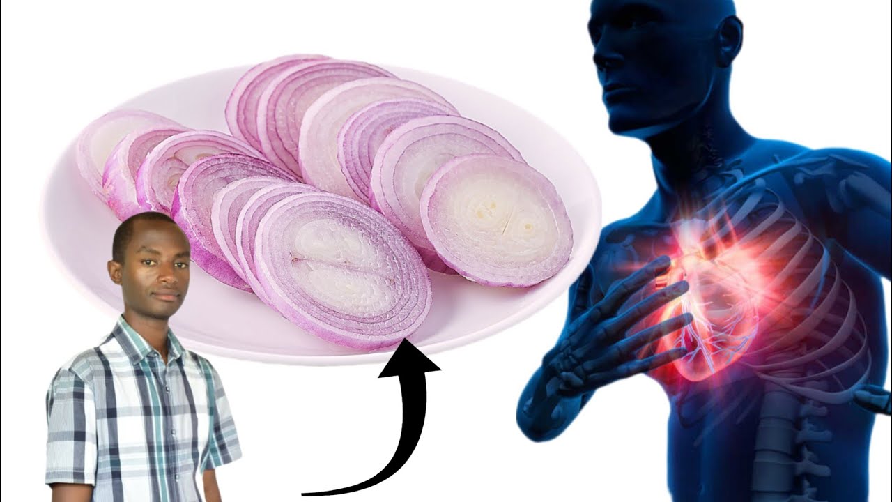 Dore ibintu 11 bitera indwara ya stroke, umuvuduko, n'umutima.