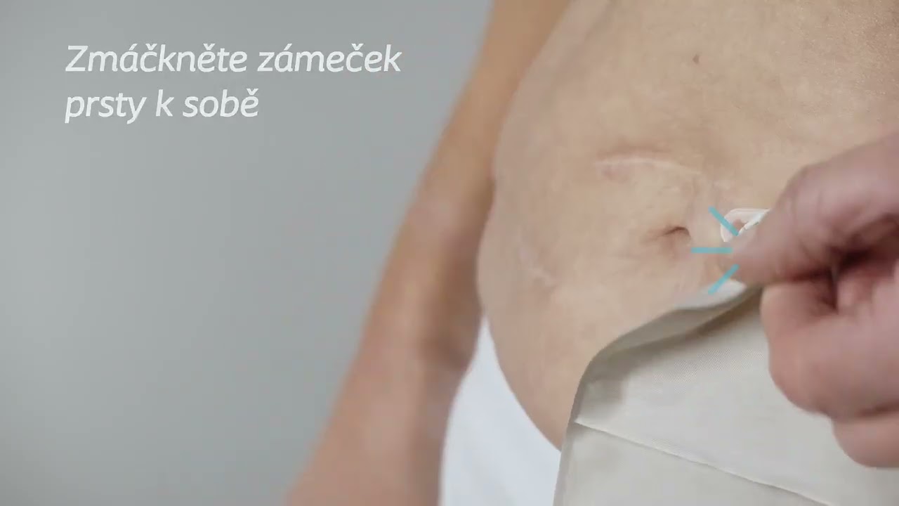 SenSura Mio Convex - 2dílný výpustný sáček s konvexní podložkou (nové vylepšené upínání) - návod