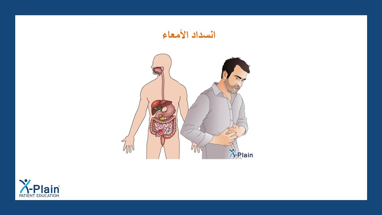 انسداد الأمعاء