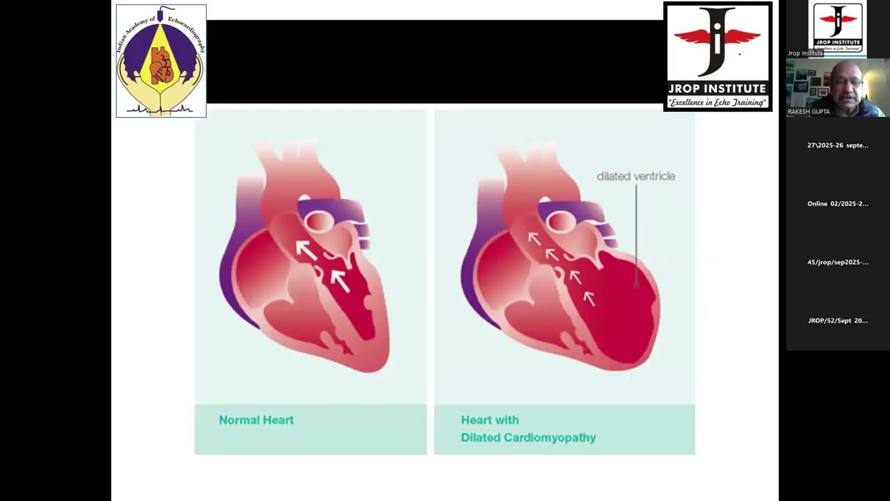 52nd 16 Session -Demo and Q & A session LV Systolic, Diastolic Function, Cardiomyopathy by Dr Rakesh