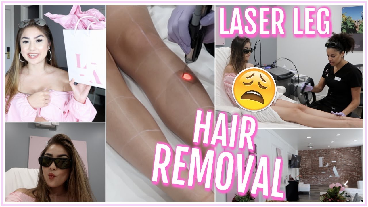 GETTING LASER LEG HAIR REMOVAL FOR THE FIRST TIME VLOG & EXPERIENCE! ♡