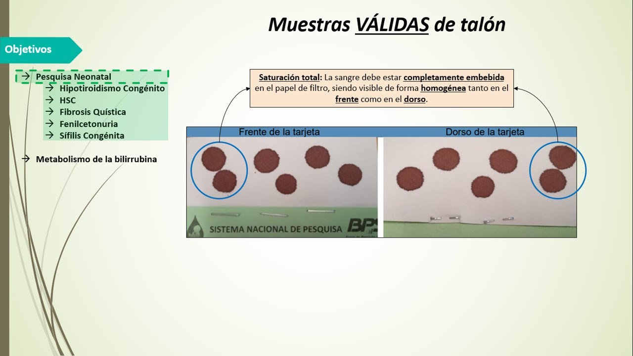 8) Fisiopatología de Pesquisa Neonatal