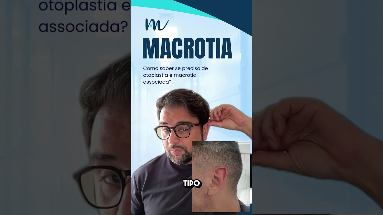Como saber se preciso de cirurgia de macrotia ou otoplastia?