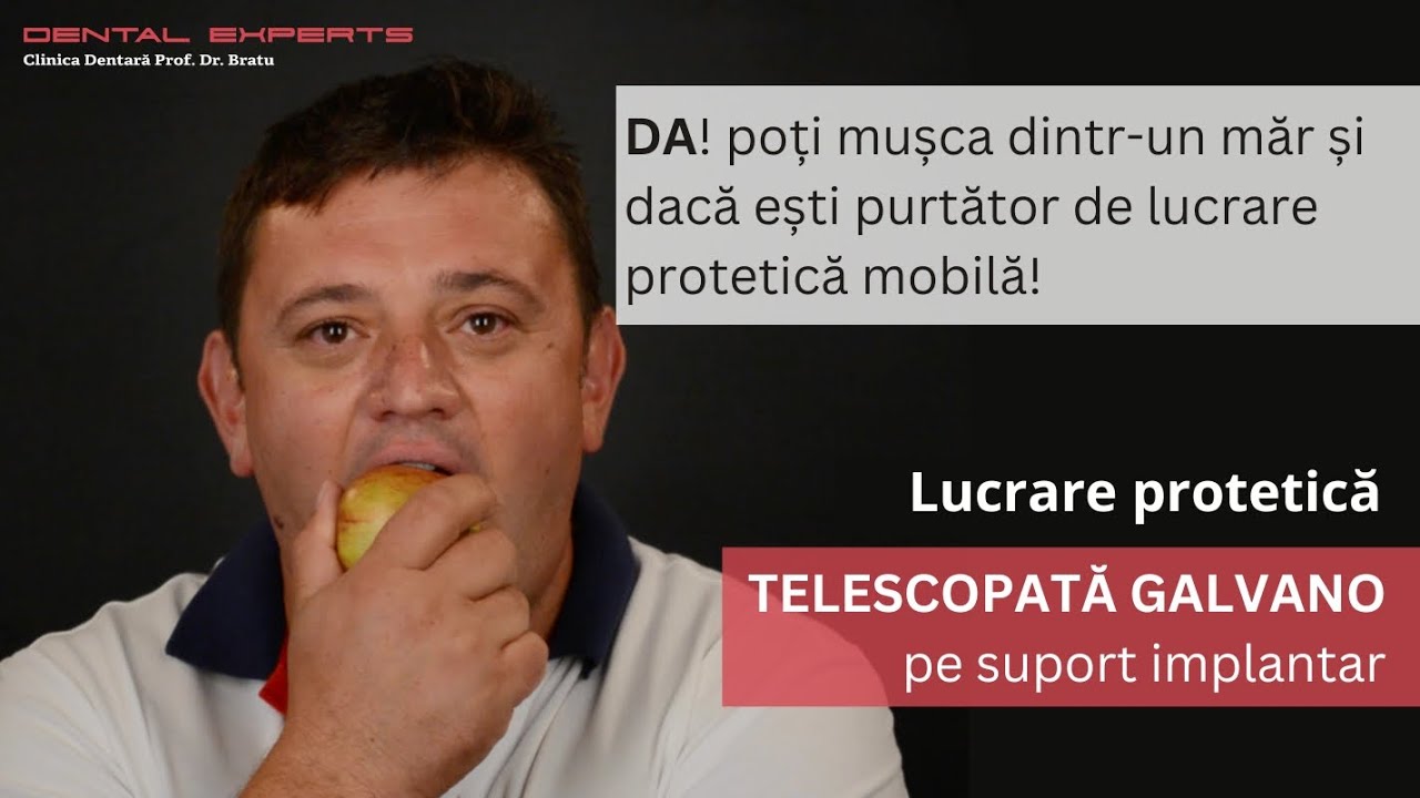 Poti musca dintr-un mar si cu proteza!