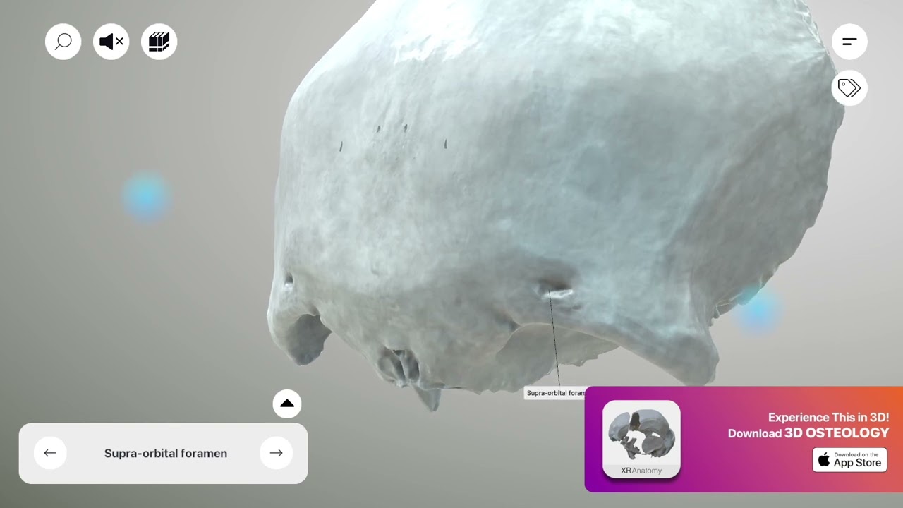 Frontal Bone - Supraorbital foramen