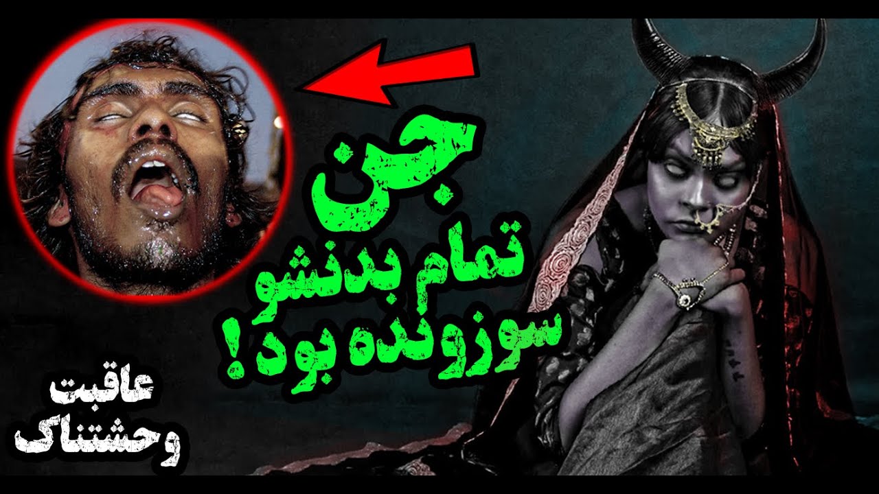 جن تمام بدنمو سوزونده بود ، همه تنم تاول زده بود / روایت دستخط