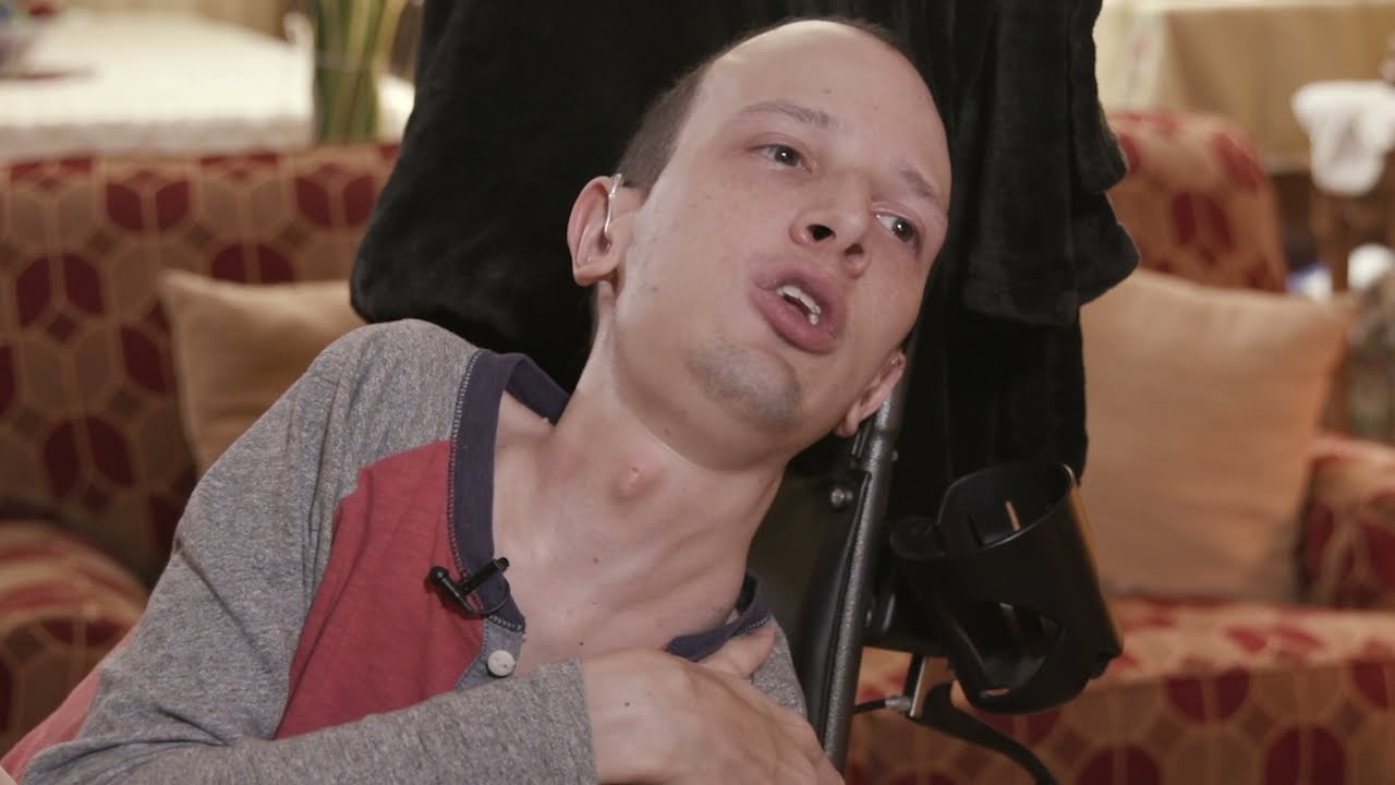 Man Turning into Stone: Find a Cure for Stone Man Syndrome FOP