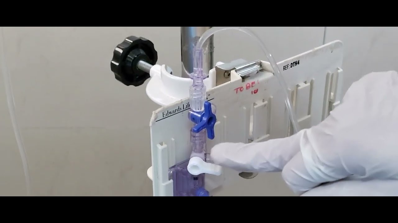 Invasive BP monitoring in neonates