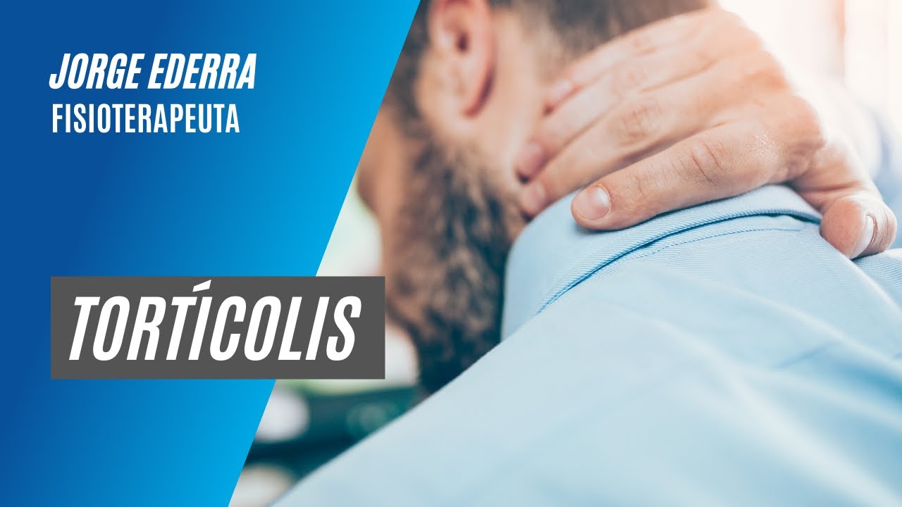 Cómo tratar la tortícolis
