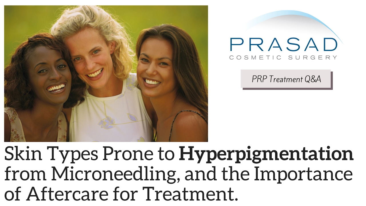 Why Facial Microneedling Causes Hyperpigmentation in Darker Skin, and Importance of Aftercare