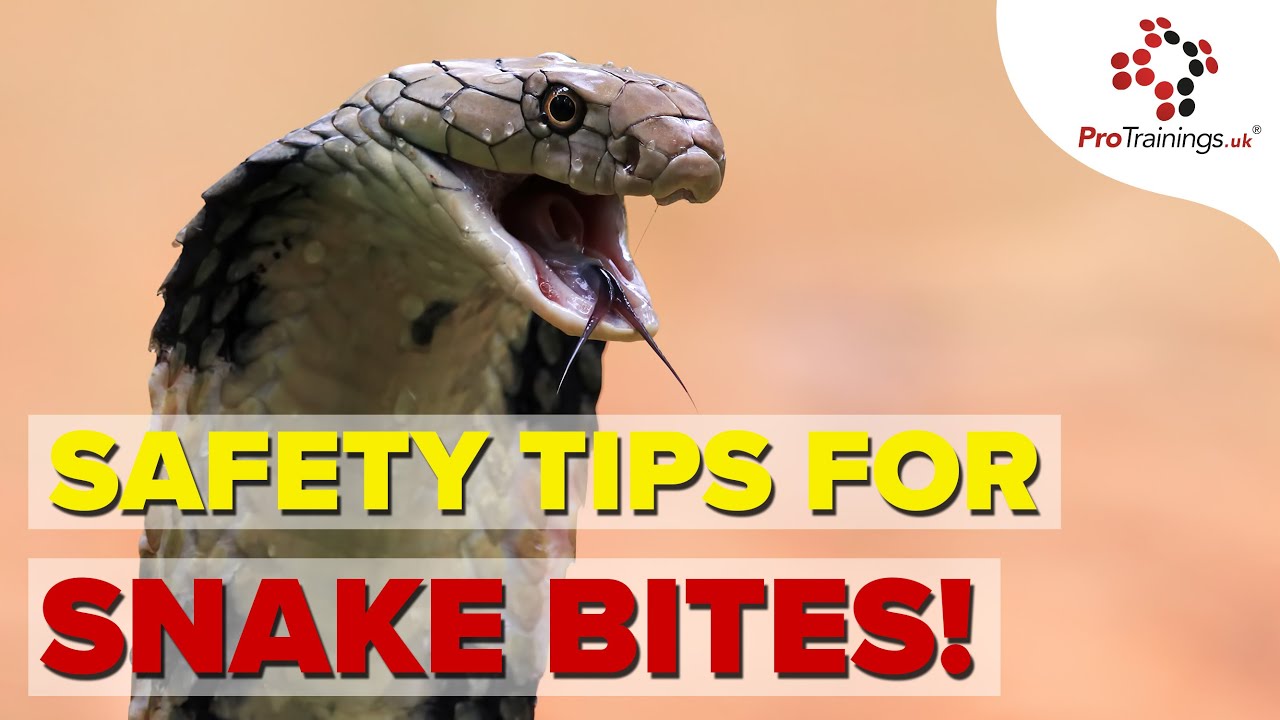 How to Handle Snake Bites: Emergency Response and Safety Tips