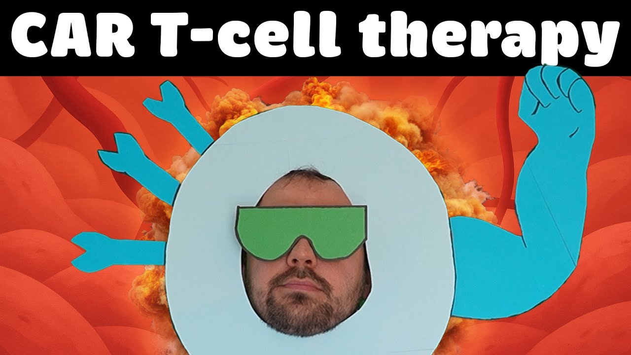 CAR T-cell therapy