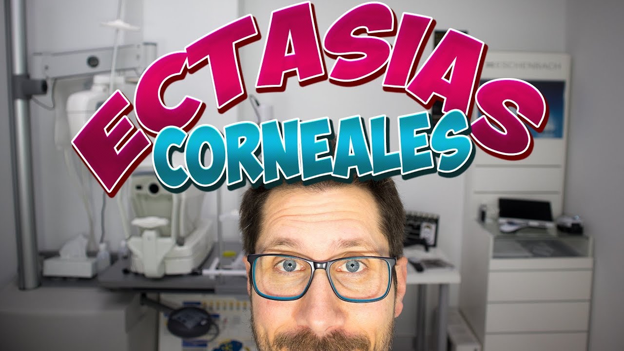 🙀 ¿SABES ya lo que es LA CORNEA IRREGULAR?