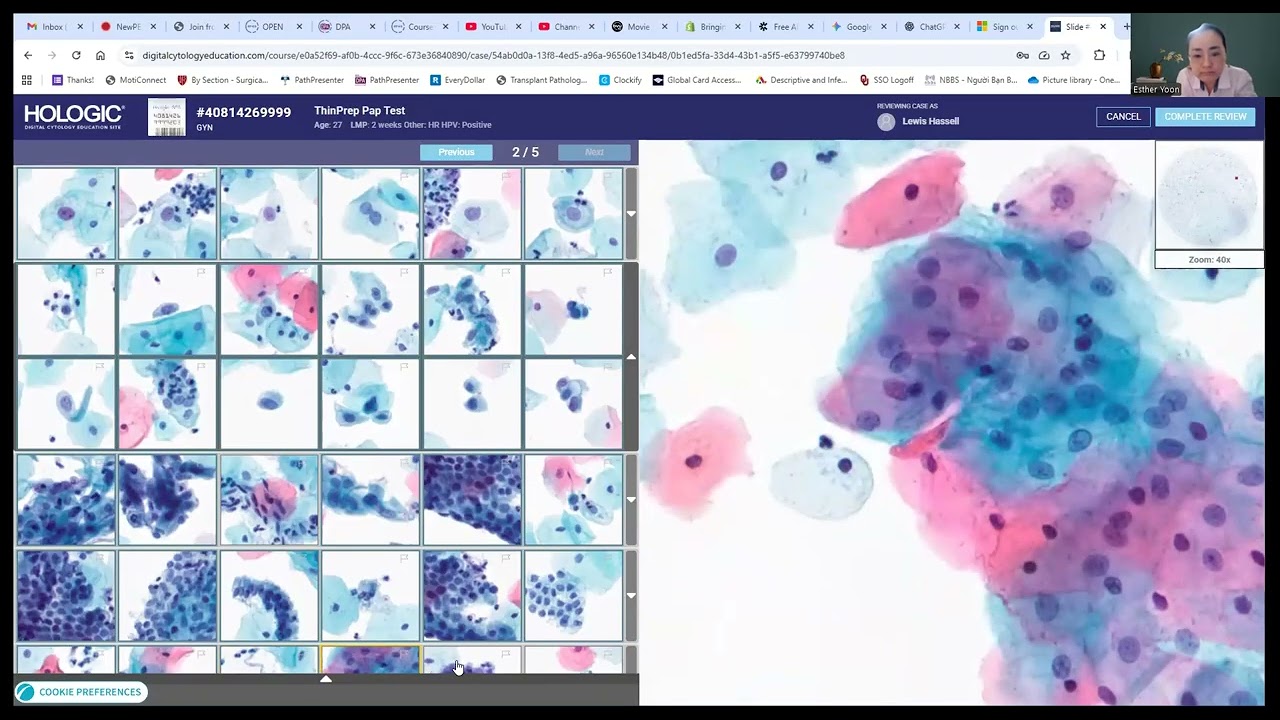 ОТКРЫТАЯ сессия наставничества Gyn Cytol 1