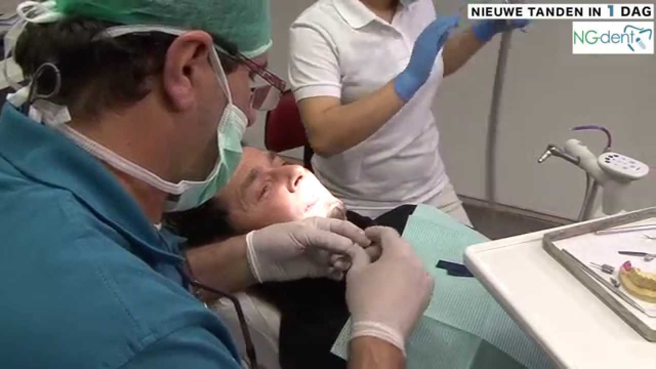 Nieuw Gebit in 1 Dag - NGdent.nl Pati&euml;nten Behandeld door Dr. Nashat Gara