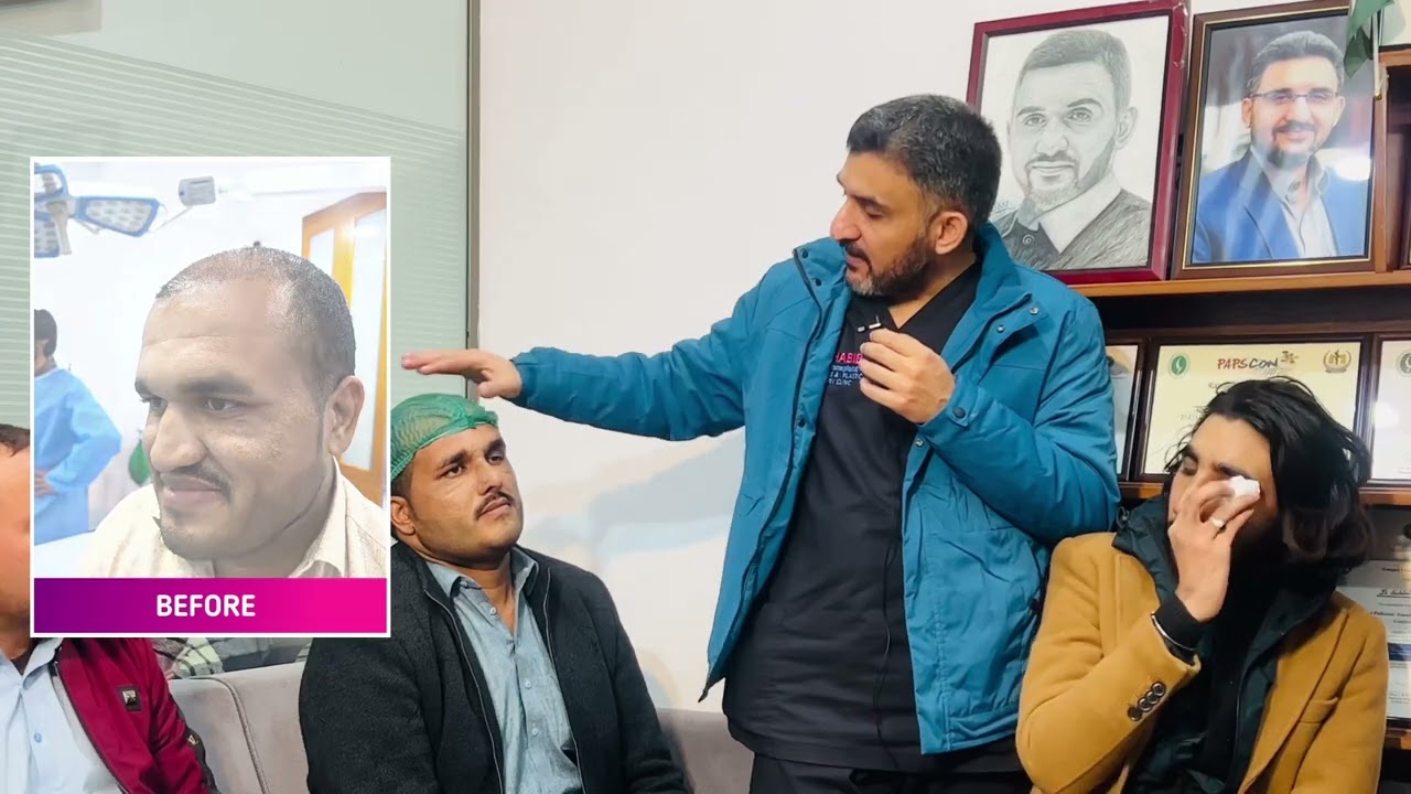 Rhinoplasty Result || Perfect Result of Rhinoplasty || Dr. Habib Ullah Shah