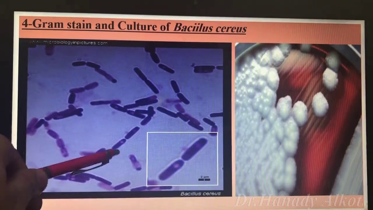 😳😳☠️Bacillus& Clostridium العملي 🤭🤭