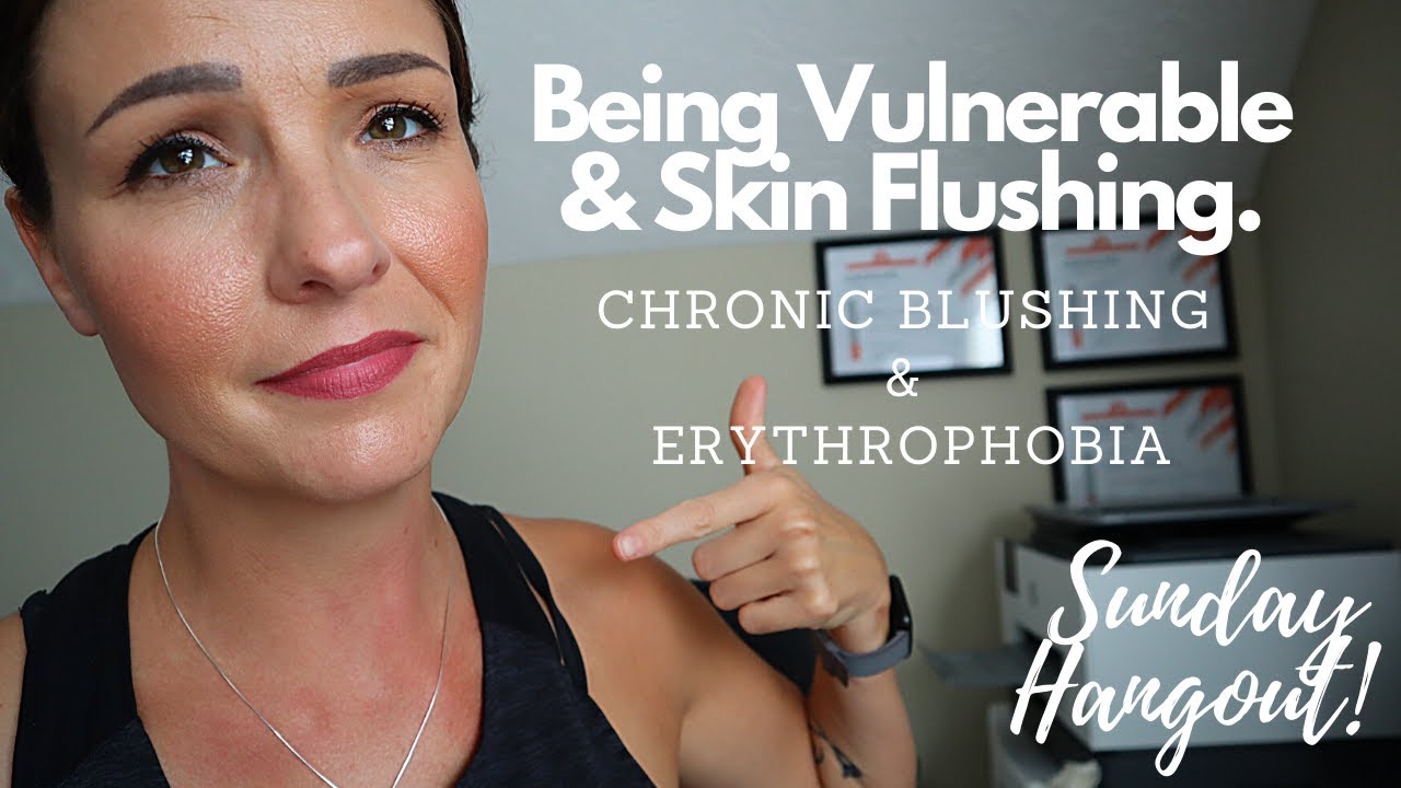 Vulnerability: Chronic Blushing, Skin Flushing, Erythrophobia