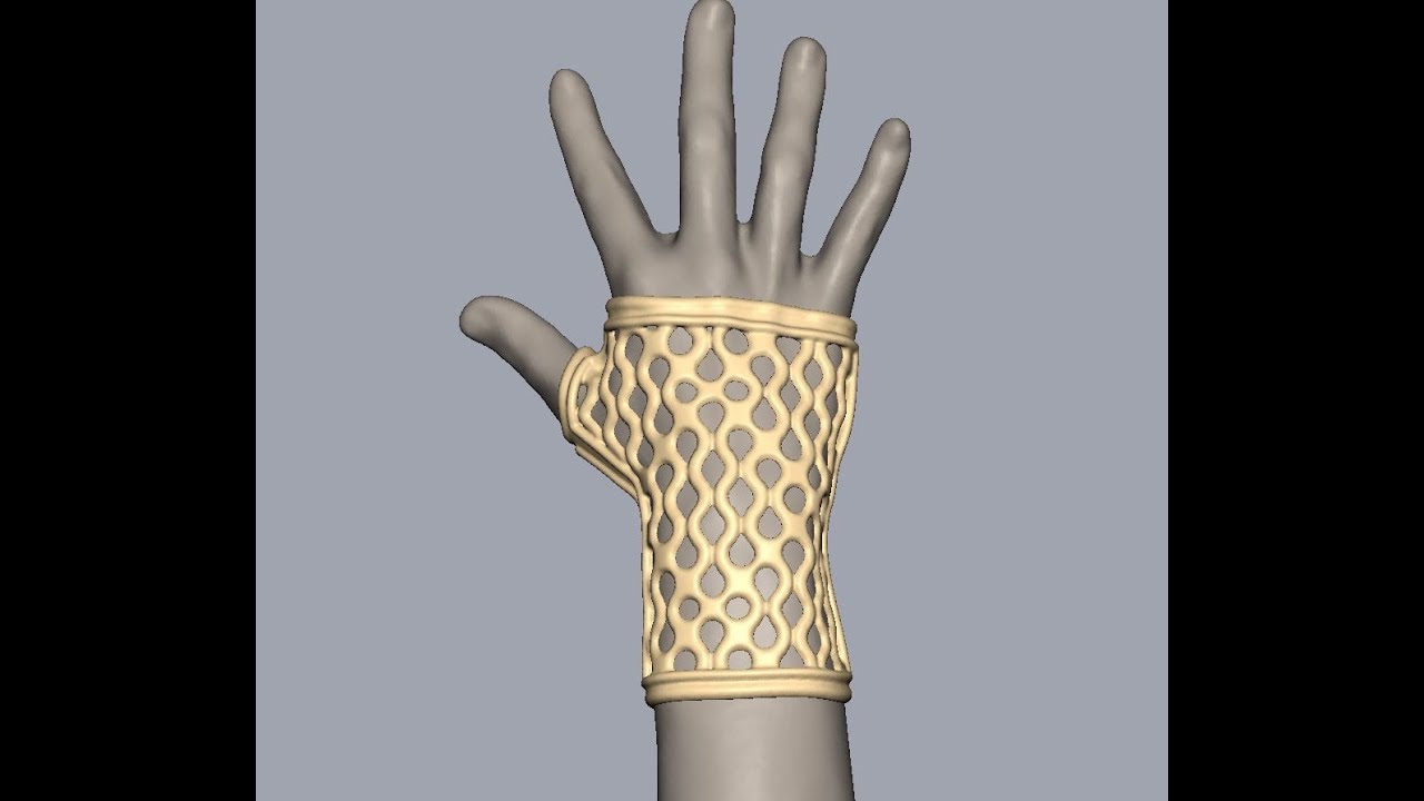 Custom Wrist Brace Design from 3d Scan Data using Geomagic FreeForm Plus