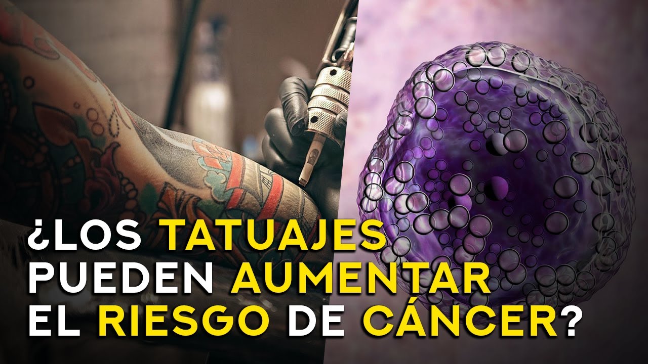 ¿Los TATUAJES aumentan el riesgo de CÁNCER? | Carlos Ali | CYTEC 08/03/2025
