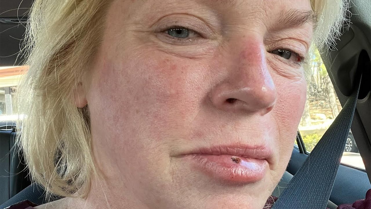 Sister Wives' Janelle Brown Shares Cancer Scare