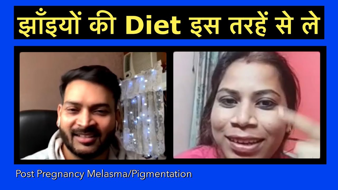 This is how you need to take Diet for Melasma/Pigmentation. झाँइयों की Diet इस तरहें से ले.