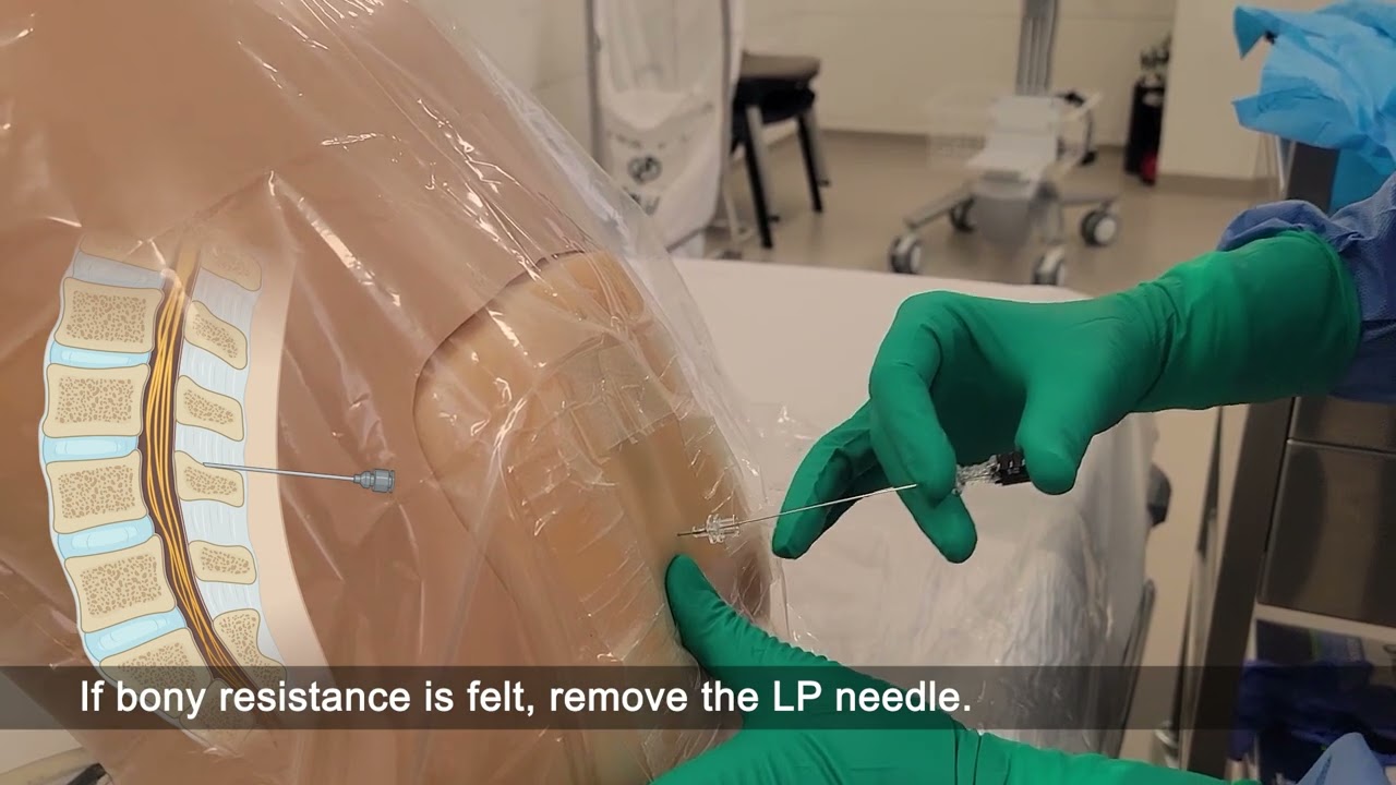 Lumbar puncture