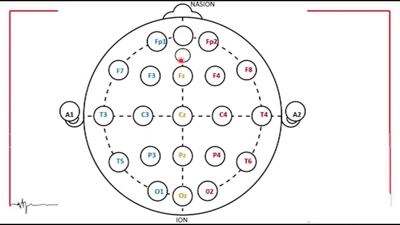 EEG Sistema 10-20
