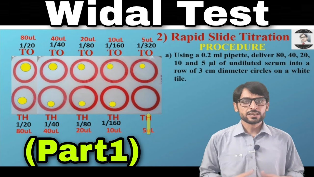 Widal Test |Part1 | Rapid Screening and Rapid Slide Titration Procedure