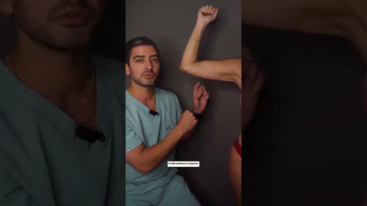 Many people think Renuvion skin tightening MUST pair with liposuction, but that&rsquo;s not true! Here&rsquo;s