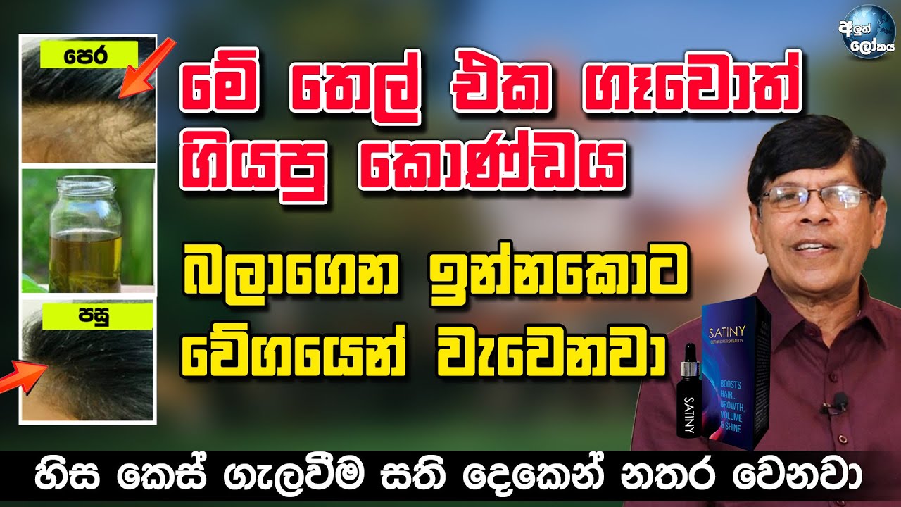 මේ තෙල් එක ගෑවොත් කොණ්ඩය බලාගෙන ඉන්නකොට වේගයෙන් වැවෙනවා - Herbal haircare Growing oil