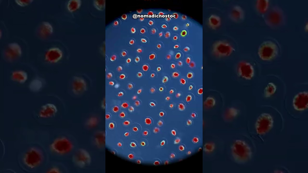 Blood Rain under a Microscope