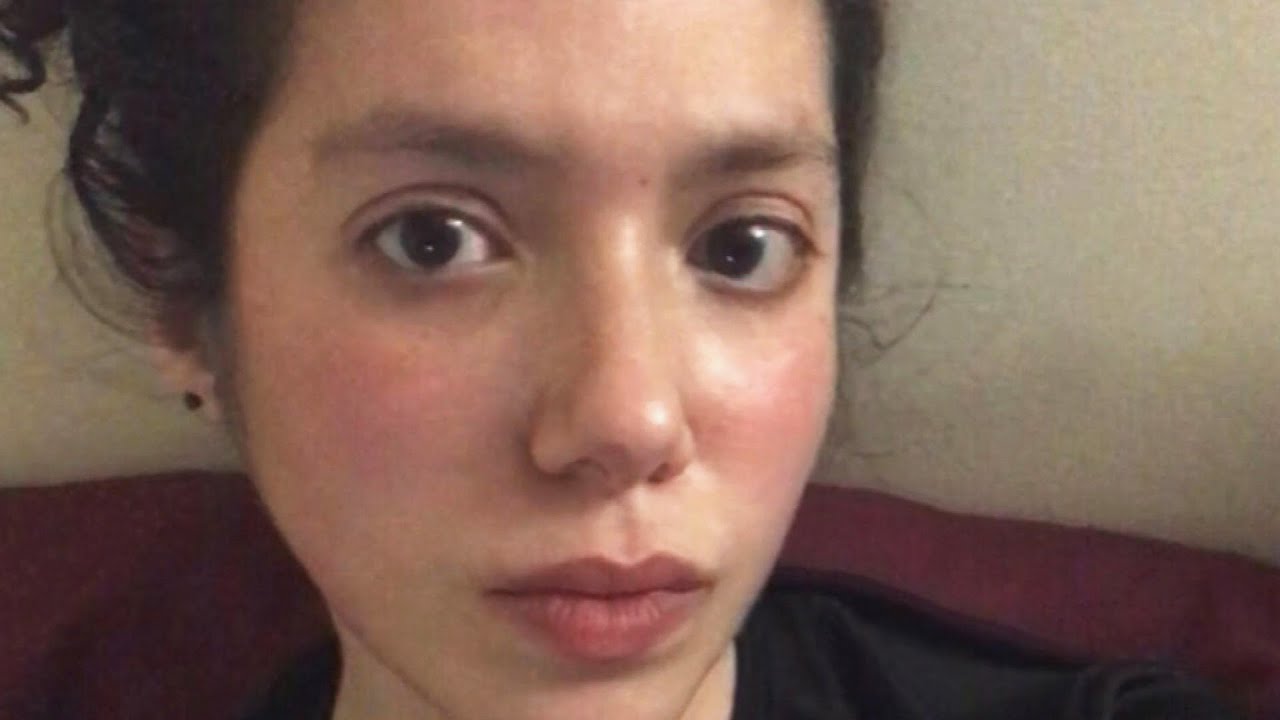 Woman With COVID-19 Symptoms for 100 Days Still Can’t Taste