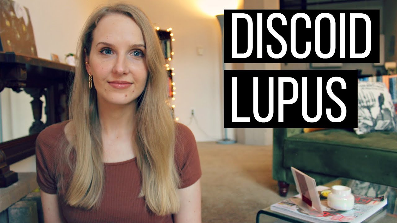Living With Discoid Lupus