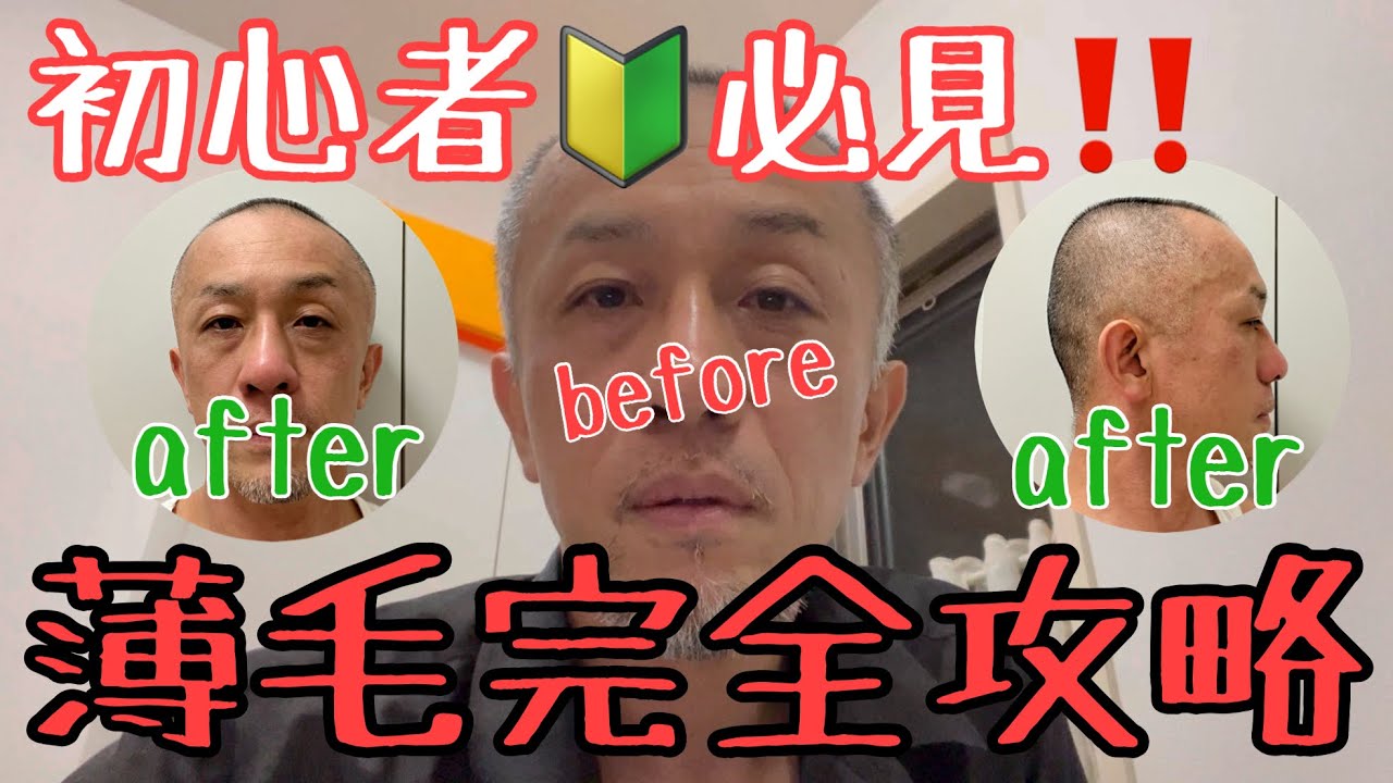 【セルフバリカン】頭頂部の薄毛で悩む人→おしゃれ坊主の人に変身する方法【人生が変わる】