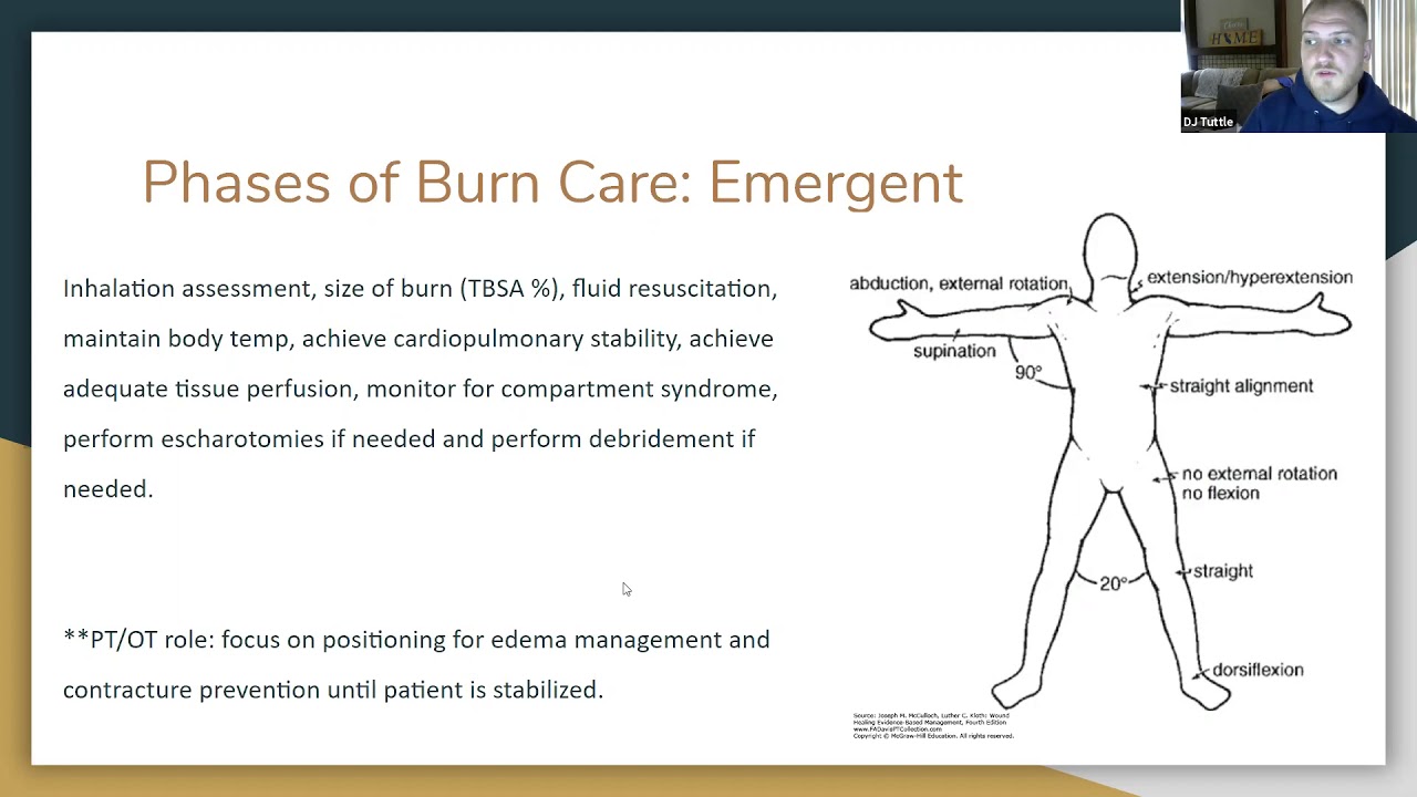 Burns Webinar by OT ECHO Mentorship Program