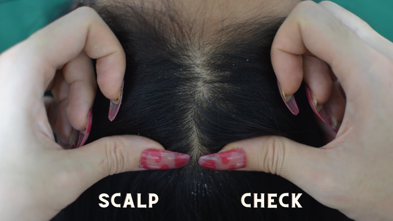 [ ASMR ] 1 Hour Scalp Check, Scalp Scratching, Scalp Treatment Relaxing For Sleep ( No Talking )