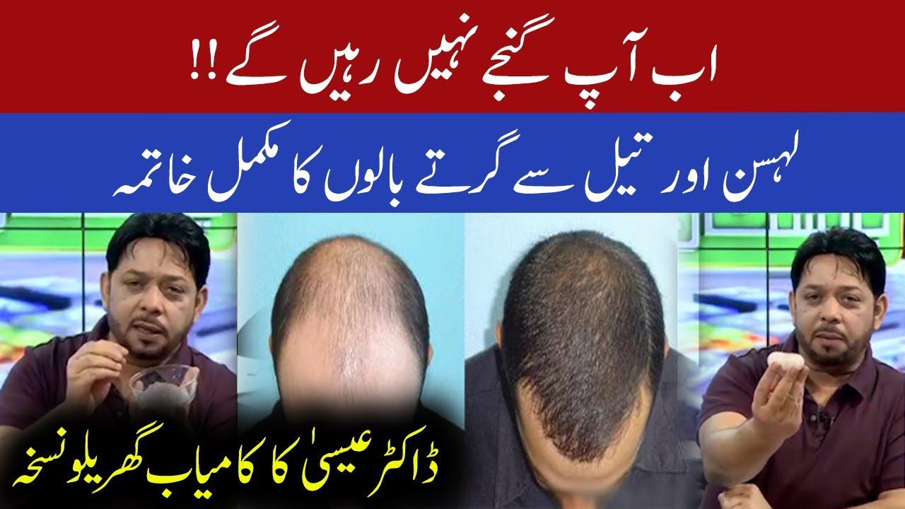 Ganjapan Khatm Karny ka asan Nuskha | Subh Savaray Pakistan | 27 February 2020 | 92NewsHD