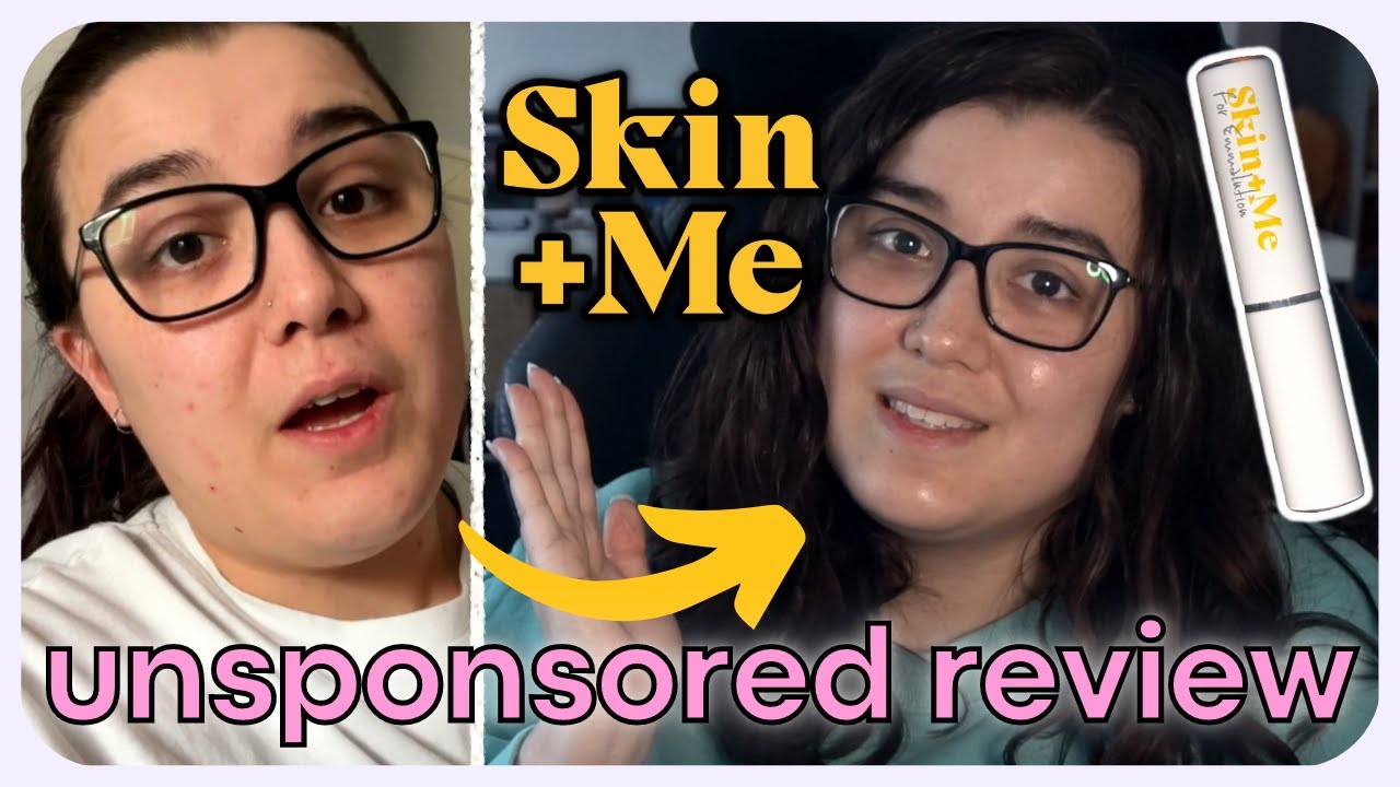 An honest and UNSPONSORED review of Skin+Me