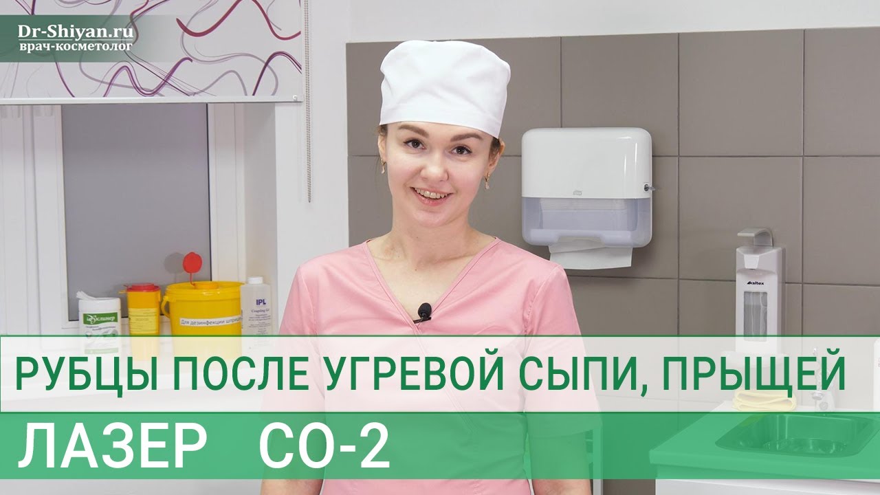 Удаление рубцов и шрамов после угревой сыпи, прыщей и акне