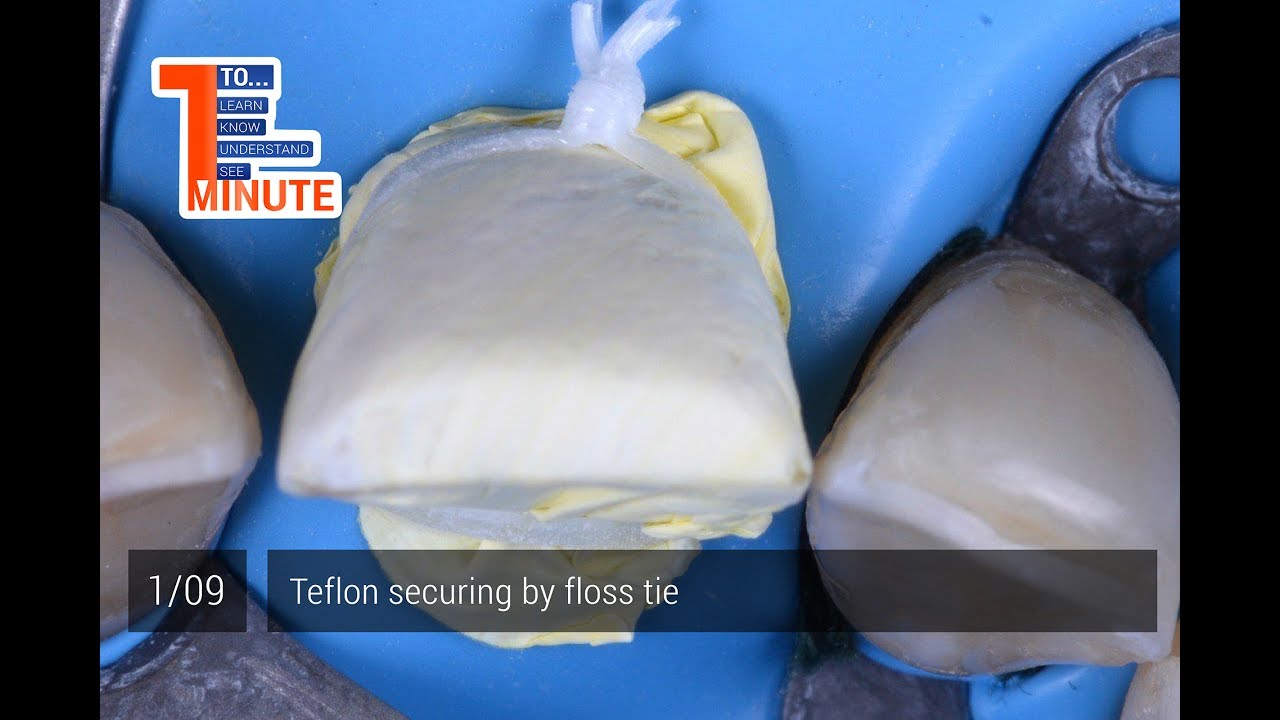 Teflon securing by floss tie.