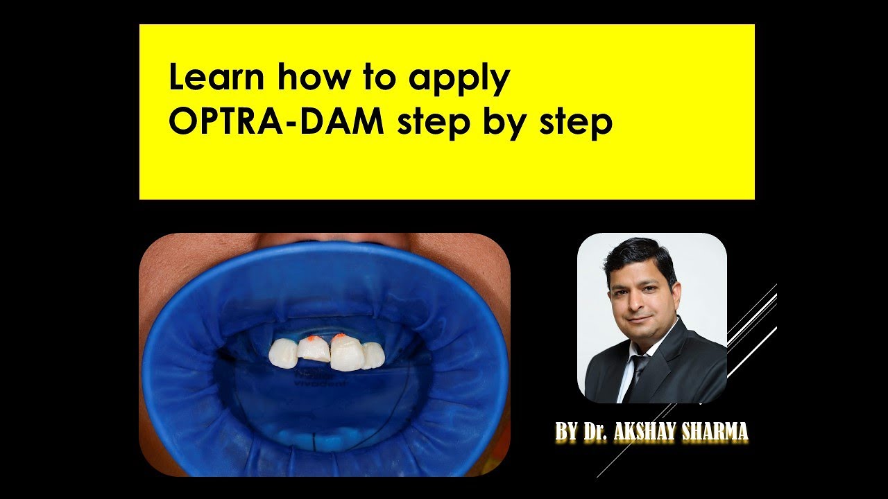 OPTRADAM PLUS Rubber dam placement