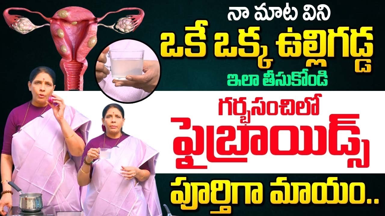 ఒకే ఒక్క ఉల్లిగడ్డ ఇలా తీసుకోండి గర్భసంచిలో ఫైబ్రాయిడ్స్ పూర్తిగా మాయం..| Aruna Yoga |‪@iDream‬