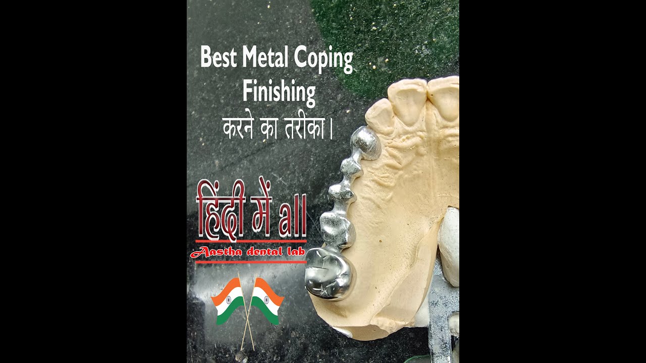 best metal coping finishing  || pfm metal coping || how to make pfm coping  || Metal Coping Wax up