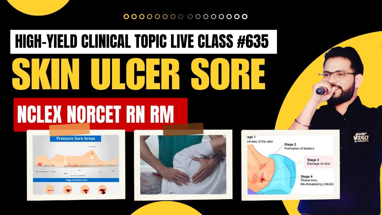 Bed Sore / Pressure Ulcer 😷 | Top MCQs for NORCET 2024 | 30-Day Challenge with Sahu Sir