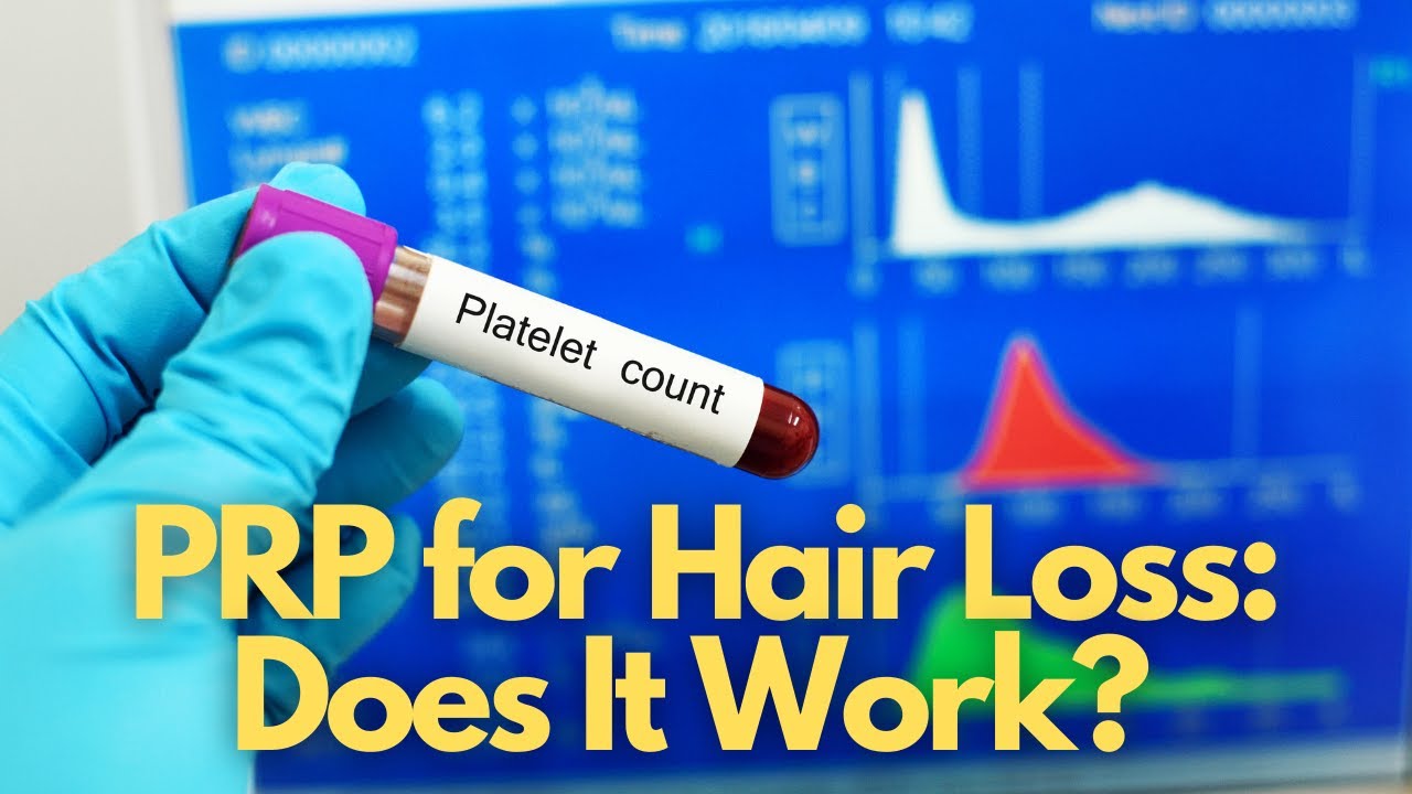 An In-Depth Review of PRP for Hair Loss